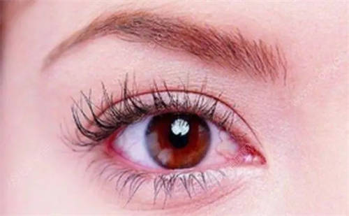 白酒喝多了眼睛有血丝 白酒喝多了眼睛有血丝