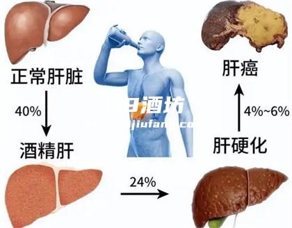 白酒喝多了会怎么样