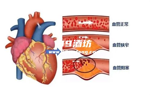 肋骨断裂还能喝白酒吗
