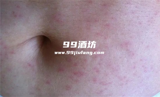 吃海鲜喝了白酒难受怎么解决