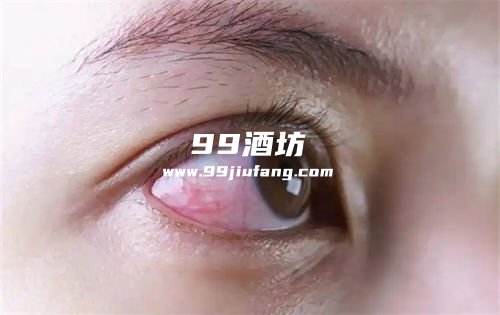 喝完白酒眼睛周围长红斑的原因