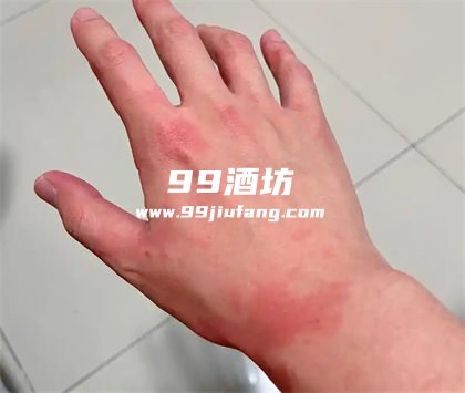 白酒可以用来洗脸吗？人久久带您了解