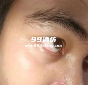 喝了白酒眼睛红不舒服咋回事