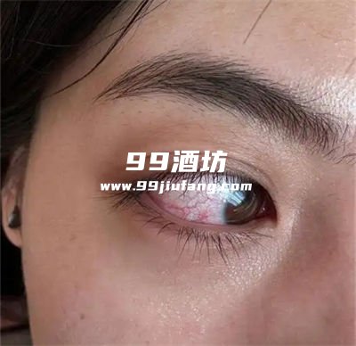 喝了白酒眼睛红不舒服咋回事