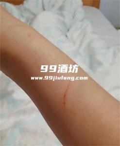 胳膊被猫抓破了能用白酒消毒吗