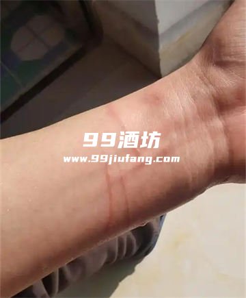 胳膊被猫抓破了能用白酒消毒吗