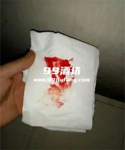 昨天喝了白酒今天便血咋回事