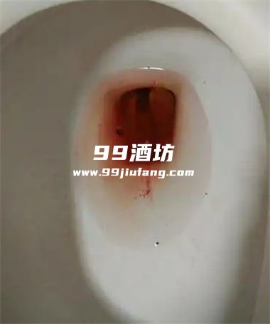 昨天喝了白酒今天便血咋回事