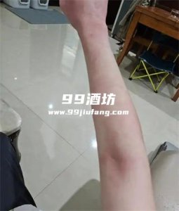 喝完白酒怎么会全身发红呢