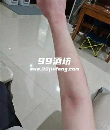 喝完白酒怎么会全身发红呢