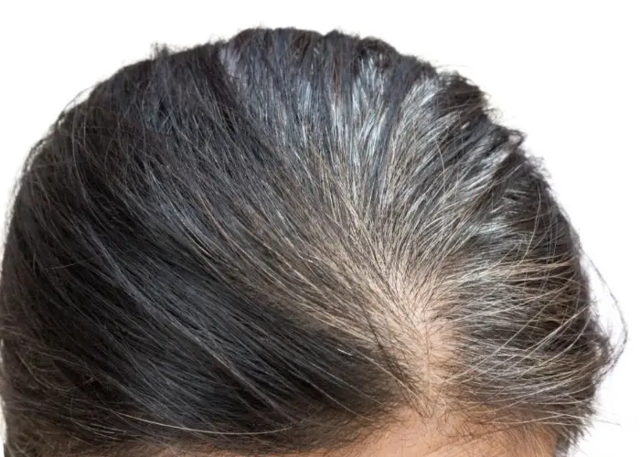 喝白酒会让头发变白吗？具体是什么原因？